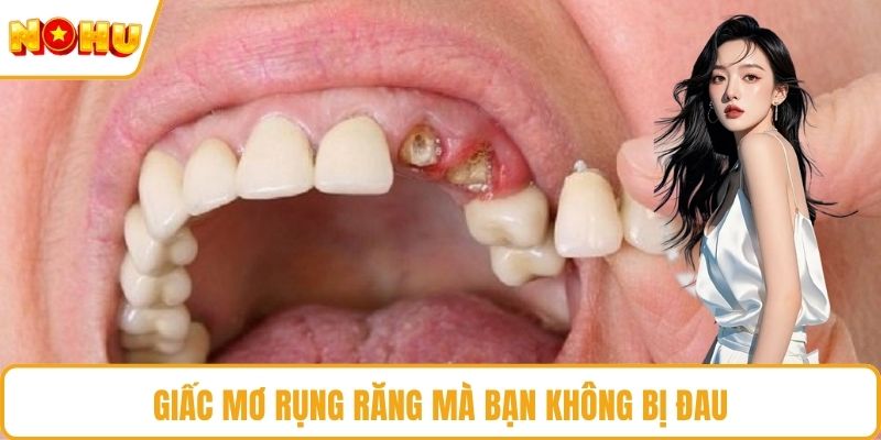 Giấc mơ rụng răng mà bạn không bị đau